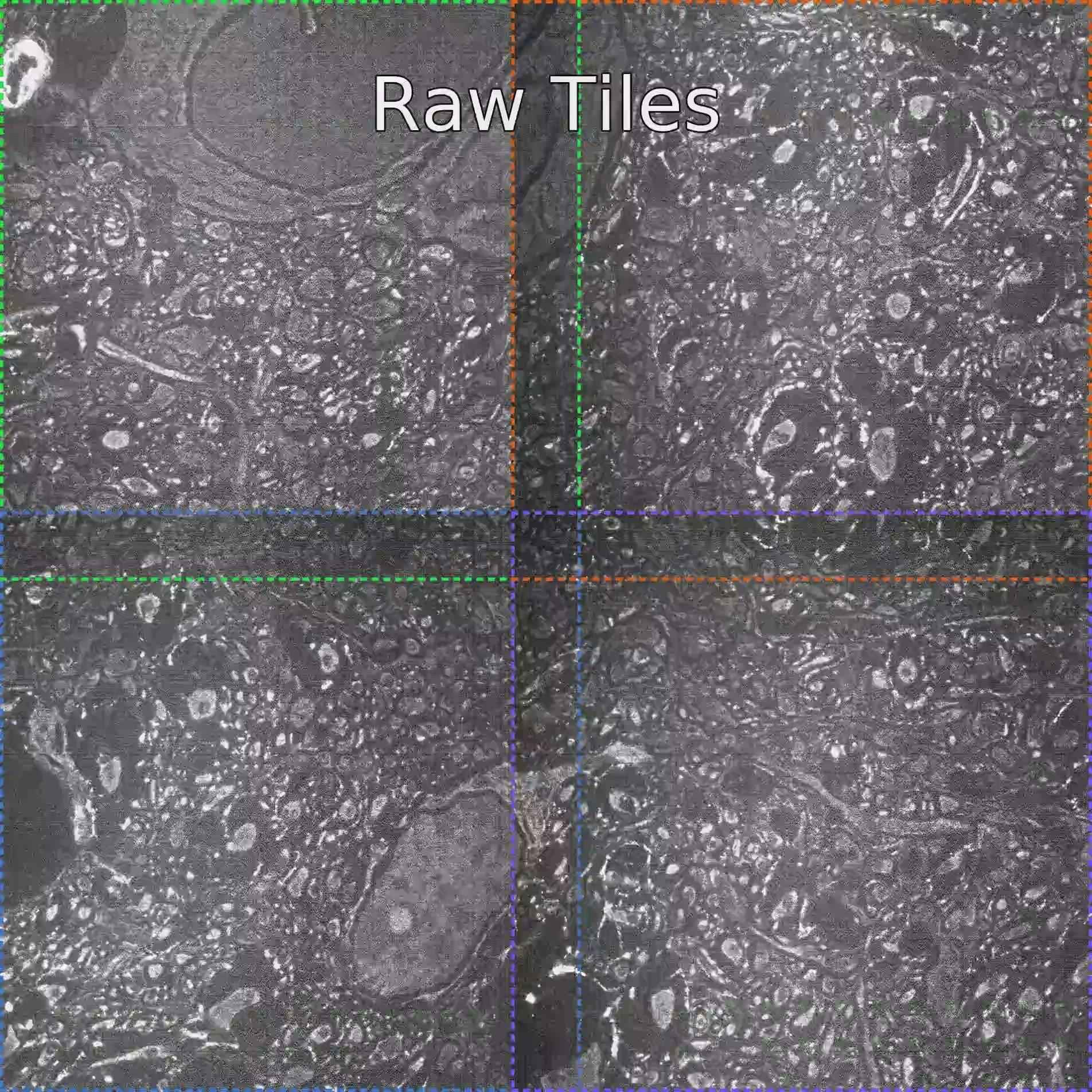 Synapse-resolution brain-scan tiles